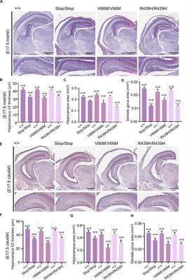 The Spindle-Associated Microcephaly Protein, WDR62, Is Required for Neurogenesis and Development of the Hippocampus